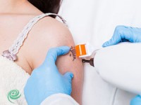 הסרת קעקועים בשיטת לייזר - כיצד זה עובד?