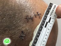 מספר אחים חשודים בדקירה