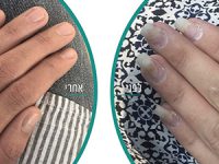 12 דברים שלא ידעתם על פטרת הציפורניים