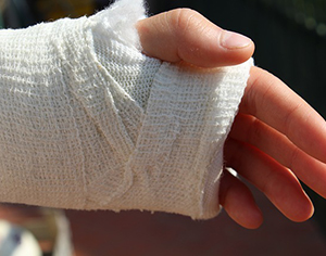 200 אלף ₪ פיצוי לאופנוען ששבר את ידו בתאונה