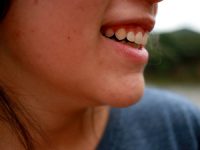 שילוב בין ידע מקצועי לחומרים הנכונים לצורך טיפול אפקטיבי באקנה