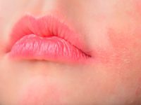 אסטמה של העור ברפואה הסינית