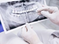 רופא שיניים מומלץ באשדוד
