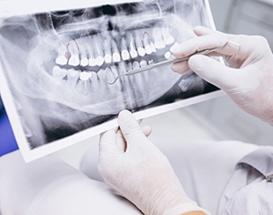 רופא שיניים מומלץ באשדוד