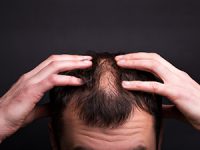 שמפו נגד נשירת שיער לגברים
