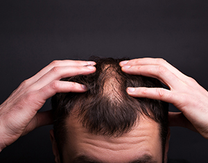 שמפו נגד נשירת שיער לגברים