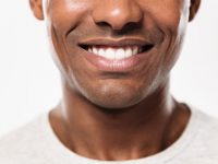 כל מה שצריך לדעת על הלבנת שיניים