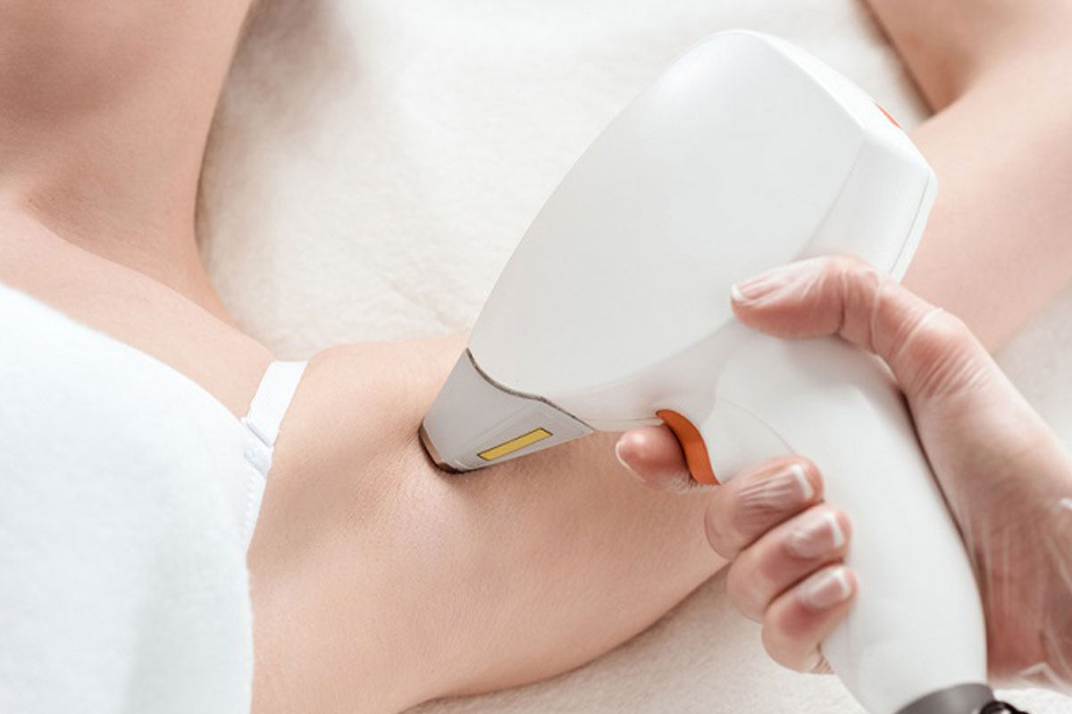 טיפולי הסרת שיער