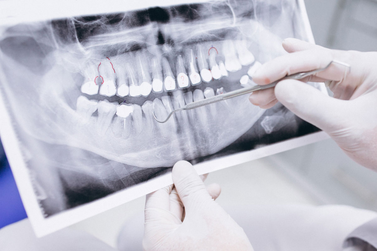תהליך נכון וטיפים למציאת רופא שיניים מקצועי עבורכם