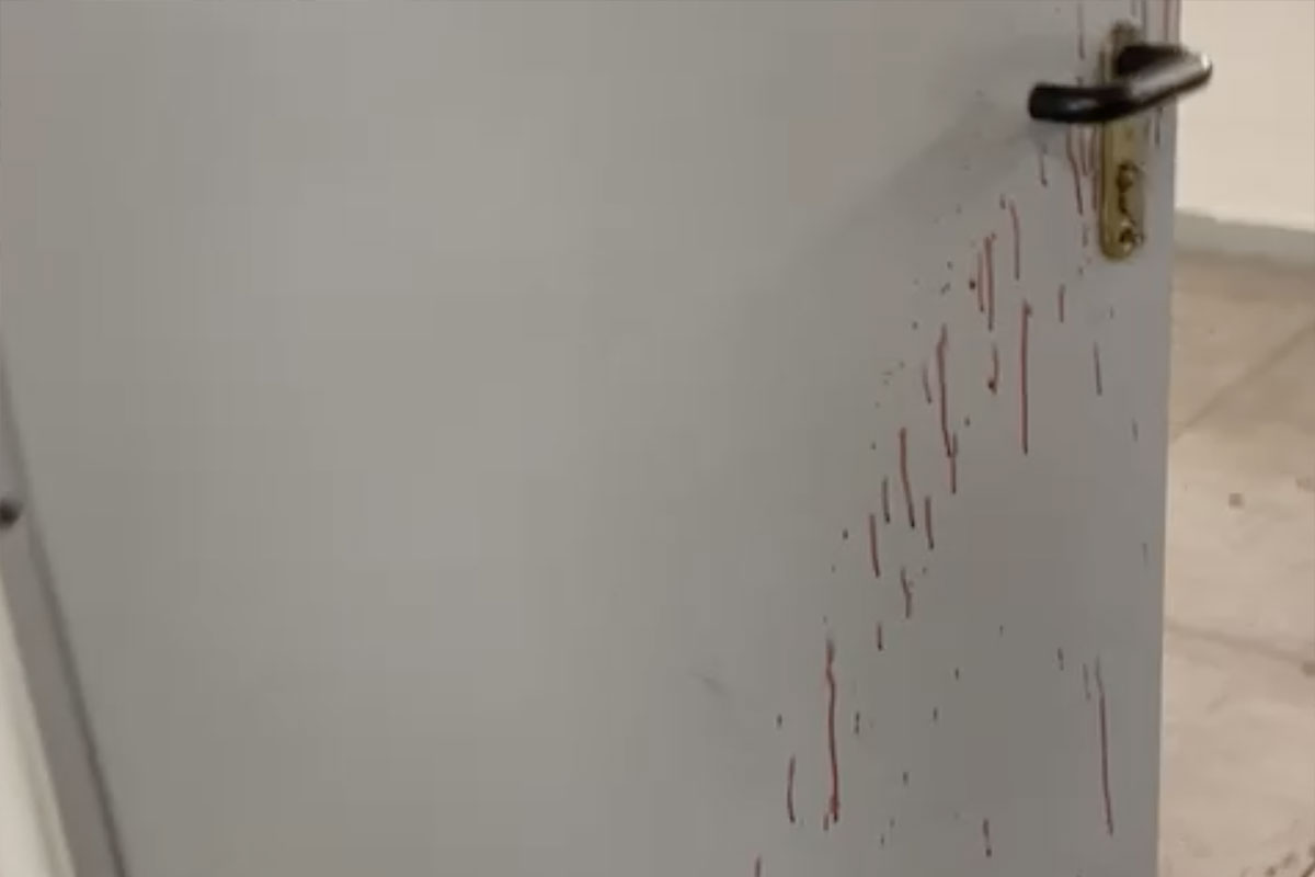 דקירה בשטח בית בית ספר: קטין נפצע באורח בינוני