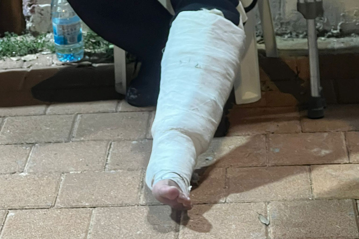 אוהד בית״ר הסליק 33 אבוקות בתוך גבס שעל רגלו