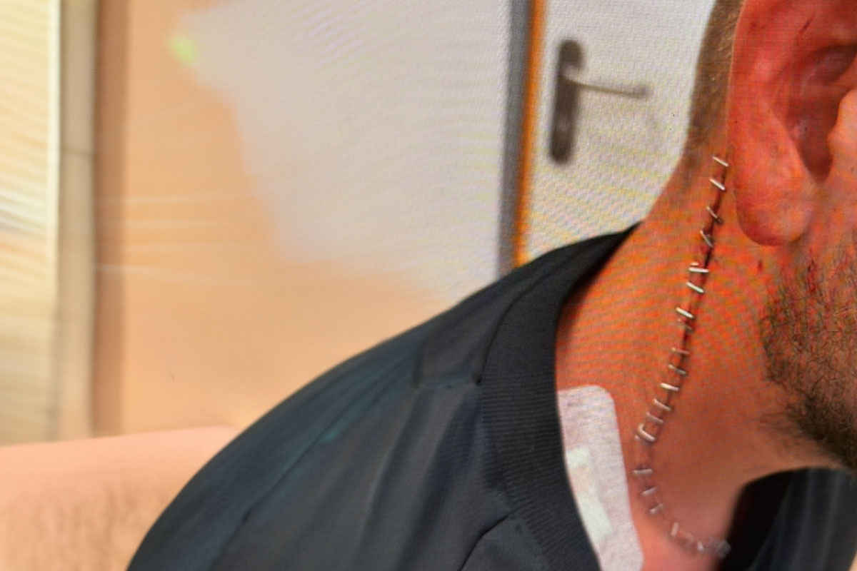 נעצרו שלושה חשודים באירוע אלימות חמור בחוף הים