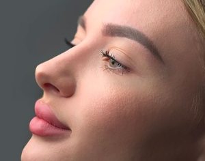 מזום ועד: TikTok כללית אסתטיקה על איך ניתוח אף הפך לאחד הניתוחים המבוקשים בעולם